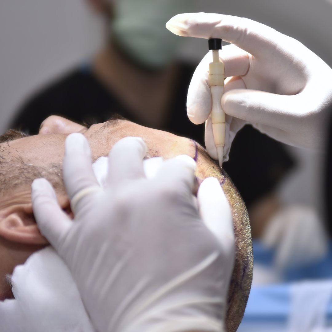 Hair clinic dermolife