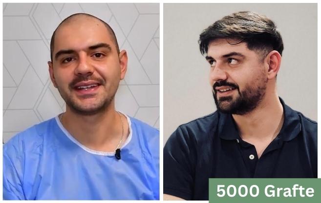 Mbjellje floku Kejdi Gishto