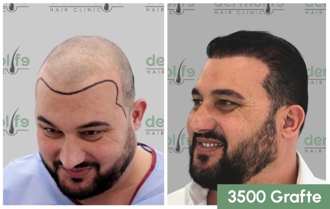 Cmimi i mbjelljes se flokeve