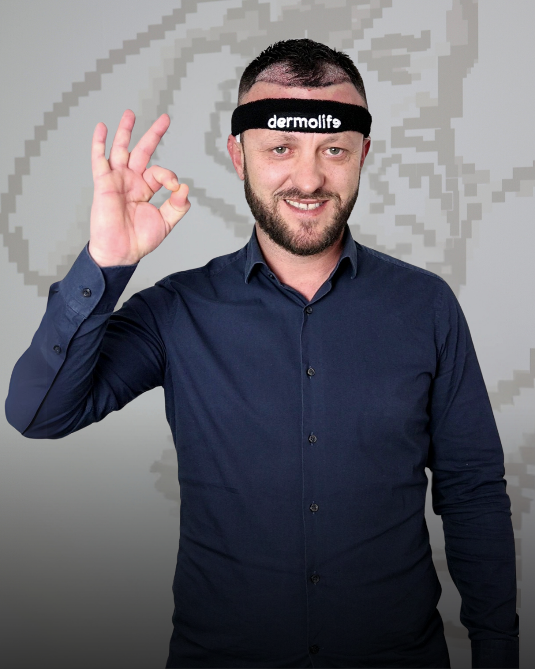 Koha e rikuperimit te flokeve pas mbjelljes