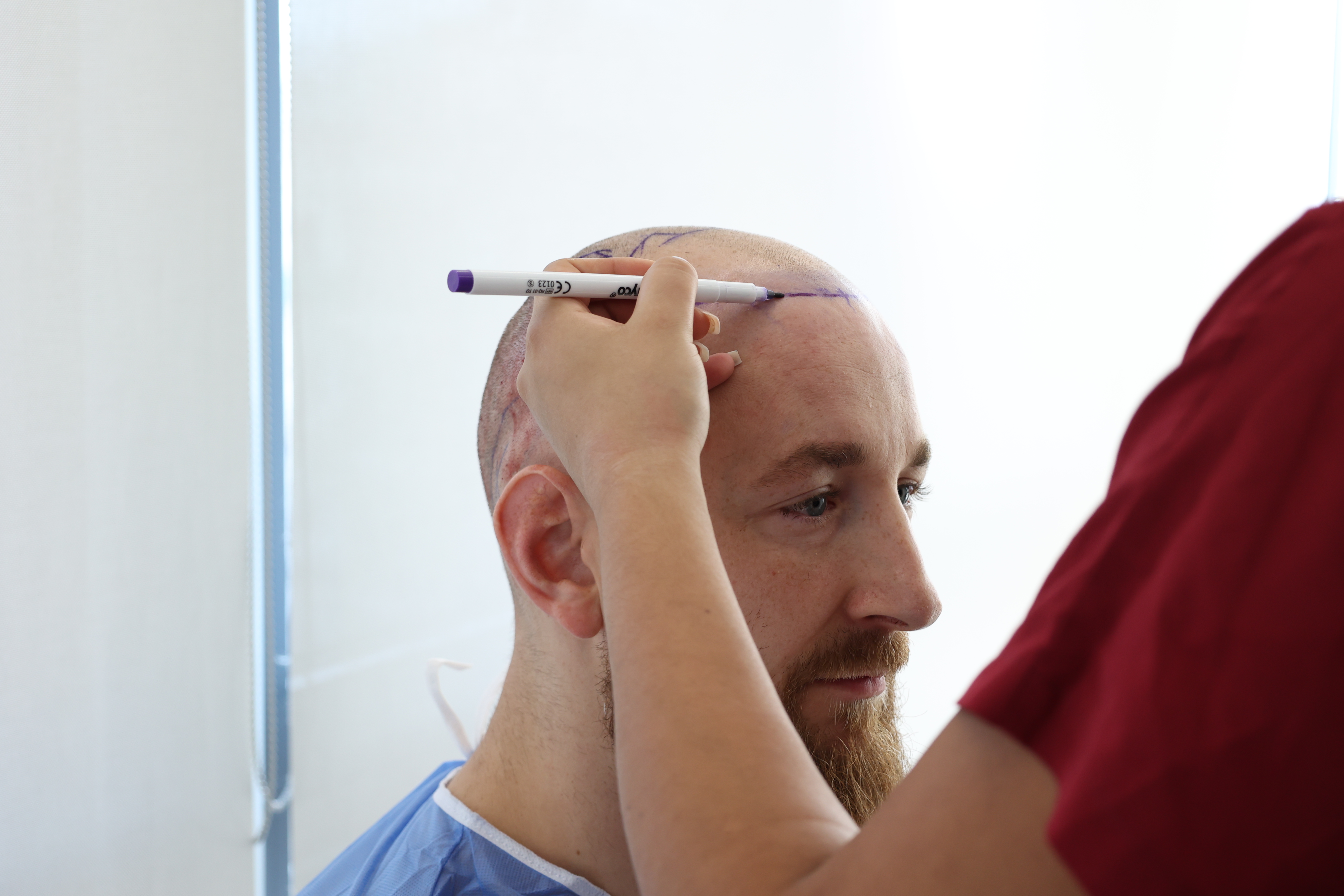 Çfarë janë sëmundjet kronike