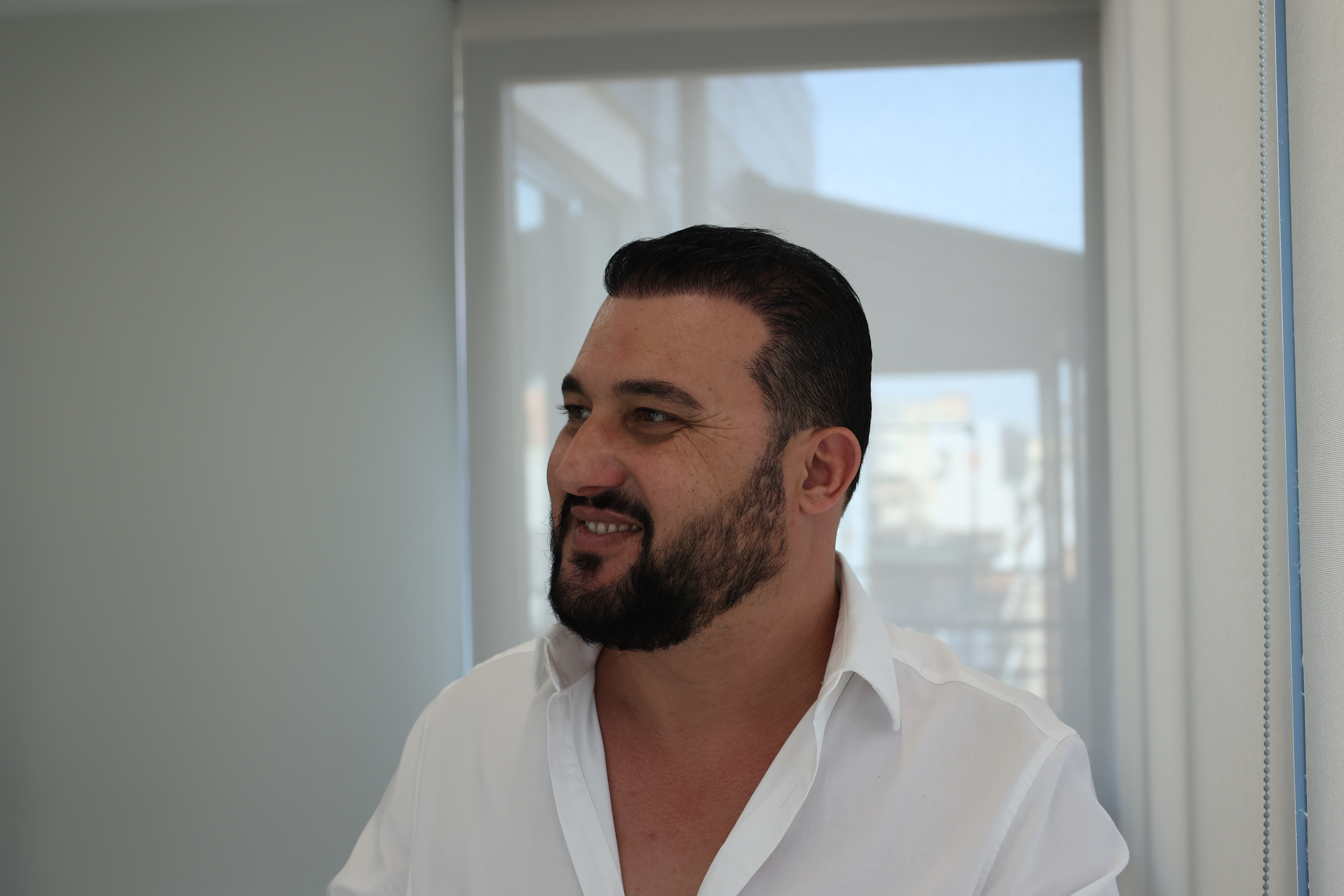 Transplanti i flokëve për pacientët me HIV